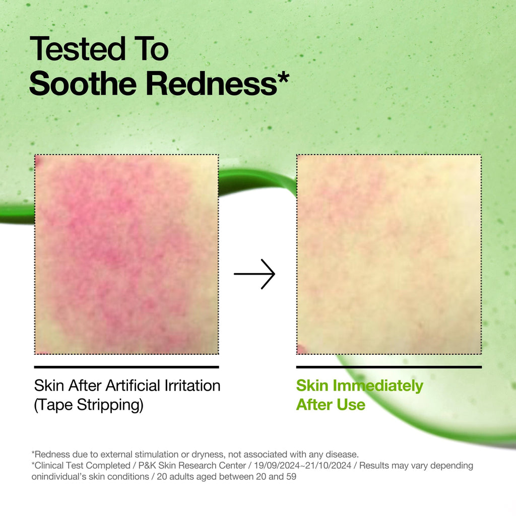 https://cdn.shopify.com/s/files/1/0753/1429/9158/files/anua-us-ampoule-serum-azelaic-acid-10-hyaluron-redness-soothing-serum-1161173133.jpg?v=1757398180